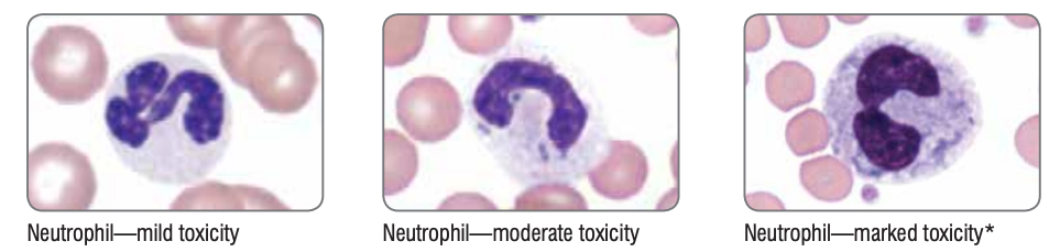 Aspect neutrofil toxic
